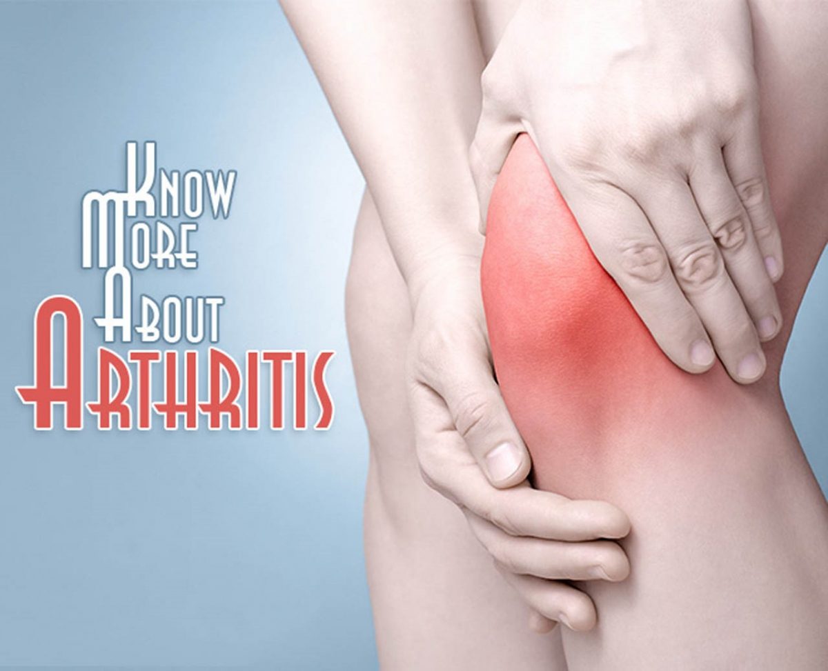Things You Should Know about Arthritis