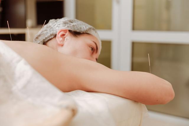 Why Workaholic Moms Can Enjoy The Benefits of Acupuncture Treatment