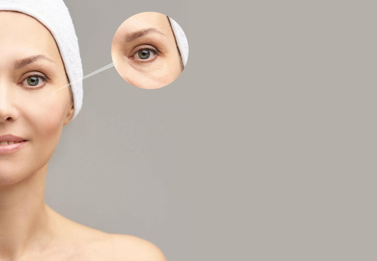 10 Benefits of Under Eye Fillers